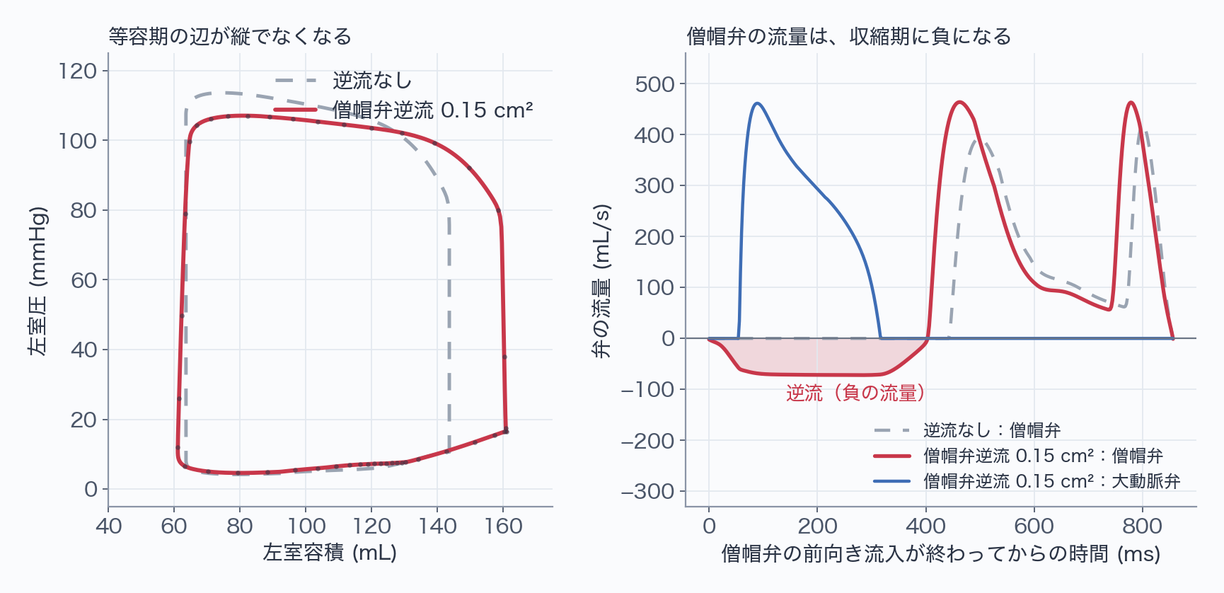左は逆流なし(破線)と僧帽弁逆流0.15 cm²(実線)の左室の圧–容積ループ。逆流ありでは右の辺と左の辺が縦でなくなり、ループが右へ広がる。右は弁の流量の時間波形で、逆流ありの僧帽弁流量が収縮期に負になり、その面積が赤く塗られている。